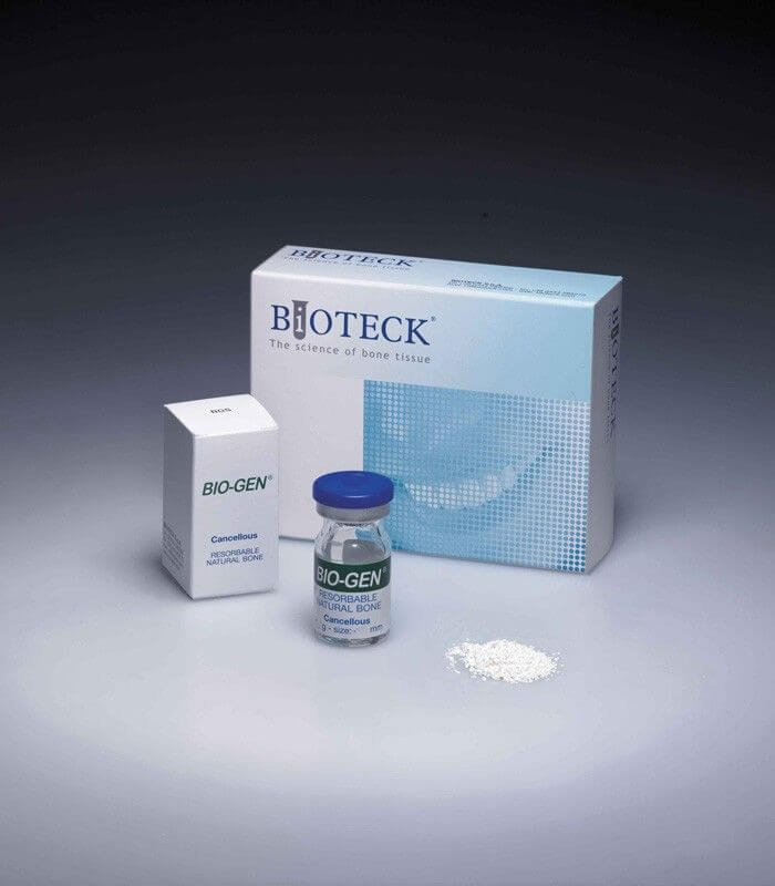Biogen Spongieux Granules -   0.5g / 1cc 1-2mm
